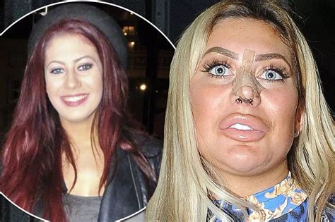 chloe ferry before after|chloe geordie shore.